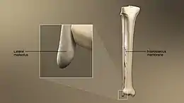 Image showing the lateral malleolus as part of the fibula.