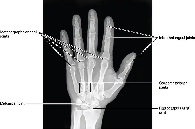 Hand Joints, X-ray