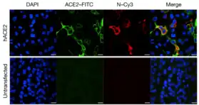 ACE2 Staining in HeLa cells.