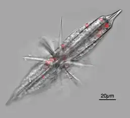 Fluorescent micrograph of an acantharian with Phaeocystis symbionts fluorescing red (chlorophyll)