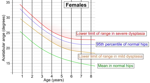 Acetabular index by age in females.