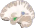 Left lateral view of the amygdala in an average human brain