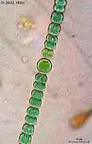 Anabaena sperica