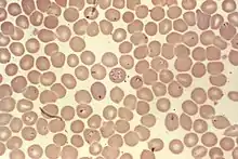 "Babesia" sp.