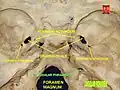 Jugular foramen