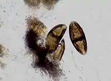 Photograph of brown, 1-septate (2-celled) spores from B. disciformis taken through a compound microscope, x1000.   (spores measure 27 x 11 micrometres)