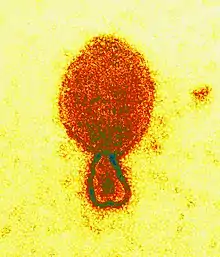 Hendra virus