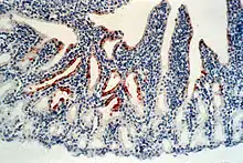 Avian orthoavulavirus 1 (stained in brown) in the conjunctiva of a chicken