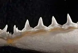 Lower teeth