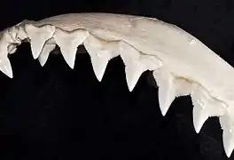 Upper teeth