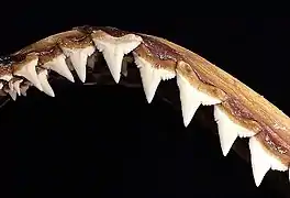 Upper teeth