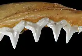 Upper teeth