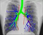 Human chest radiographic anatomy.