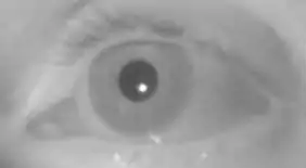 Infrared / near-infrared: dark pupil and corneal reflection.