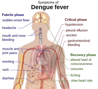 Outline of a human torso with arrows indicating the organs affected in the various stages of dengue fever