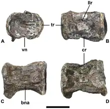 A gray vertebra seen from four angles