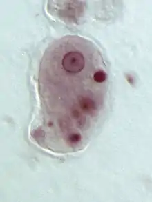 Entamoeba histolytica trophozoite