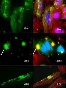 Fluorescence microscopy of DNA Expression in the Human Wild-Type and P239S Mutant Palladin.