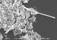 Filamentation (top right of electron micrograph) occurs in some bacteria when PBP3 is inhibited.