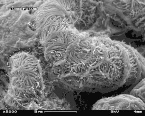 Scanning electron microscope image of a glomerulus in a mouse (5000x magnification)