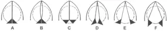 Diagram of glottis positions