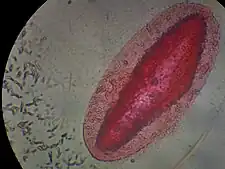 Prokaryotes (small cylindrical cells, bacteria, on left) and a single-celled eukaryote, Paramecium