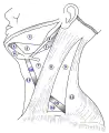 The triangles of the neck. (Anterior triangles to the left; posterior triangles to the right. Suprahyoid labeled at left.)