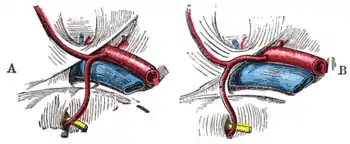 Variations in origin and course of obturator artery