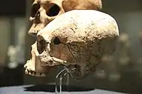 A deformed female human skull in Olmec and Gulf Coast Gallery, in the National Museum of Anthropology (Mexico)