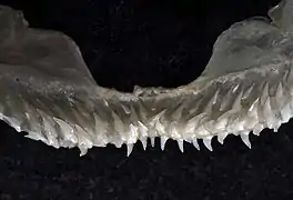 Upper teeth