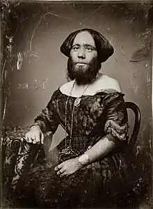 Portrait of Josephine Clofullia. She sits on a wooden chair and leans against a cloth-covered table. Around her neck is a long chain that is connected to a pocket watch that sits in her lap. She wears bracelets, many rings, and a brooch that holds a daguerreotype of her husband, Fortune Clofullia, a landscape painter.