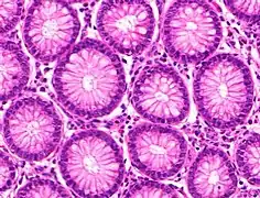 Micrograph of normal large instestinal crypts.