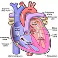 Diagram of tricuspid insufficiency/regurgitation. Marked in black arrow.