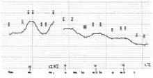 Voicetrack of the sentence Mwamúna, ámalamúlá amáyi ('A man, he rules women') (Myers (1996), p. 34), illustrating a boundary tone after mwamúna, and also the typical downdrift of tones through the sentence.