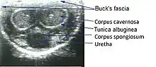 Medical ultrasonography of a normal penis.