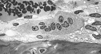 Osteoclast displaying many nuclei within its "foamy" cytoplasm.