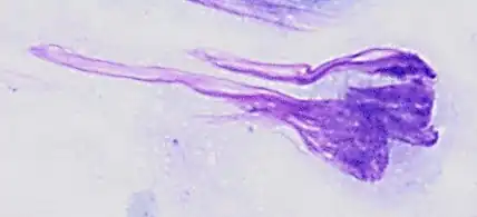 Smearing of cells across a glass plate may cause smearing artifacts, such as the nuclear smearing of this monocyte, shown as tail-like extension of nuclear material.