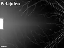 First person view of a Purkinje Tree while sitting in a slit lamp/biomicroscope