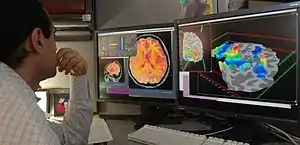 A researcher analyzing functional MRI images of the brain