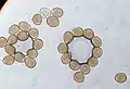 Urediniospores of a rust fungus.