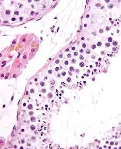 Seminiferous tubule (right) with sperm (black, tiny, ovoid). H&E stain.