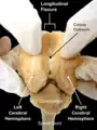 Sheep Brain Dissection with labels