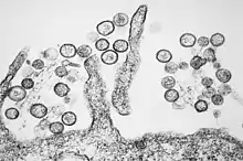 Transmission electron micrograph of "Sin Nombre orthohantavirus"