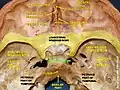 Body of sphenoid bone