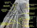 Adductor pollicis muscle