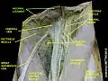 Inguinal ligament