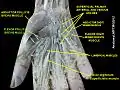 Flexor pollicis brevis muscle