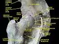 Hip joint. Lateral view. Iliac fossa.