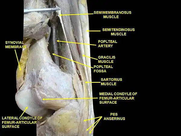 Muscles of thigh. Lateral view.