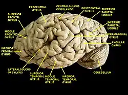 Cerebrum. Lateral view. Deep dissection. Inferior temporal gyrus labeled at bottom center.